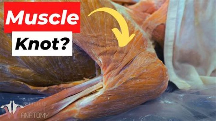 What Does A Knotted Muscle Look Like